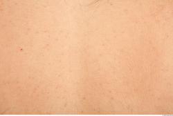 Photo Textures of Human Skin